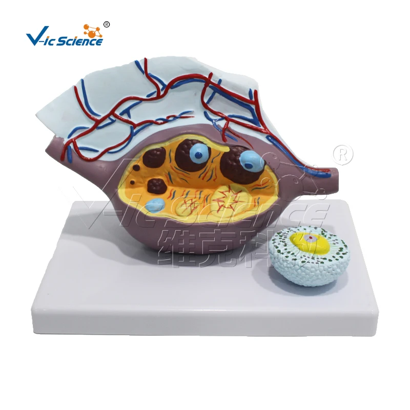 

Ovarian anatomical magnification model