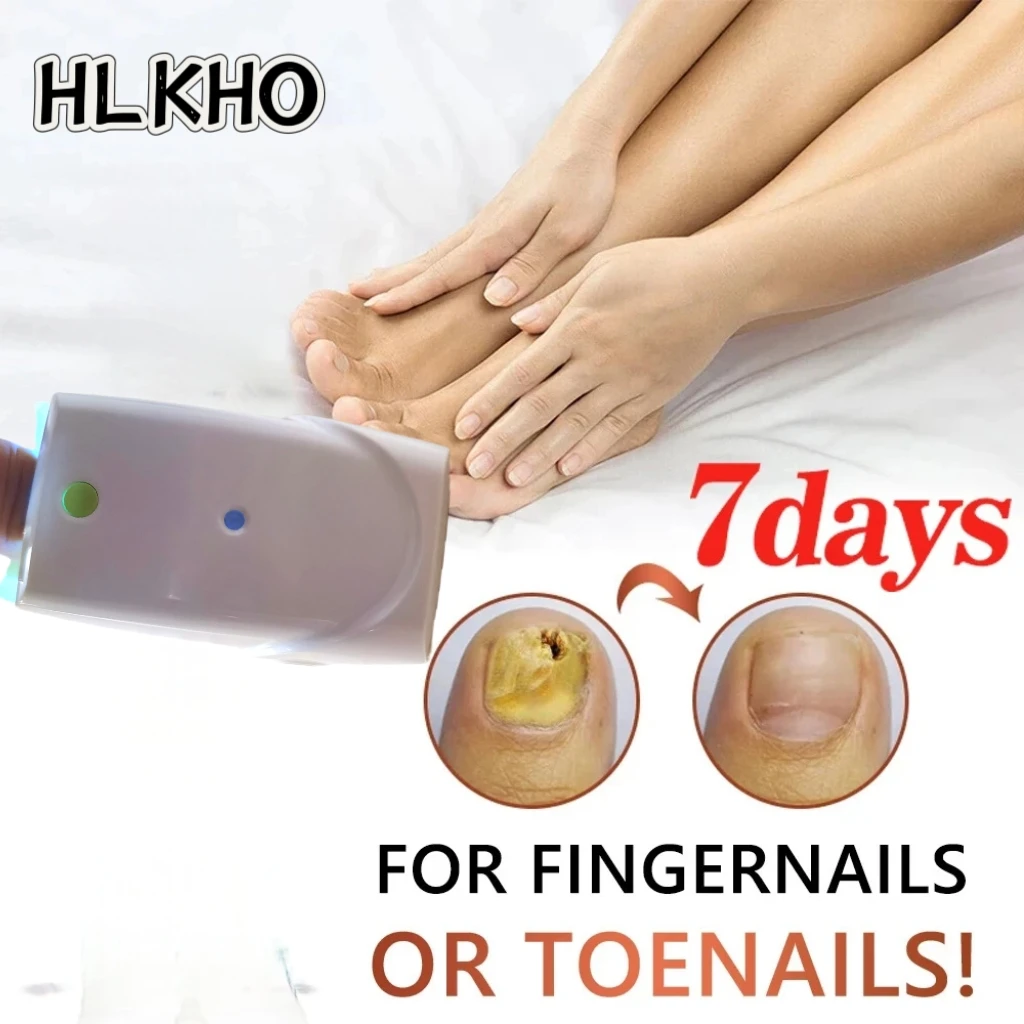 

Advanced Nail Fungus Treatment Device Laser for Toenail Fingernail Onychomycosis Repair, Thick Nails Cleaning Care