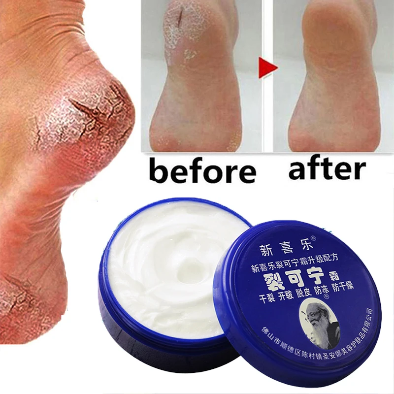 Effective Chinese Anti-Drying Crack Foot Cream Heel Cracked Repair Cream Removal Dead Skin Foot Mask Chapping Care 33/55/85g