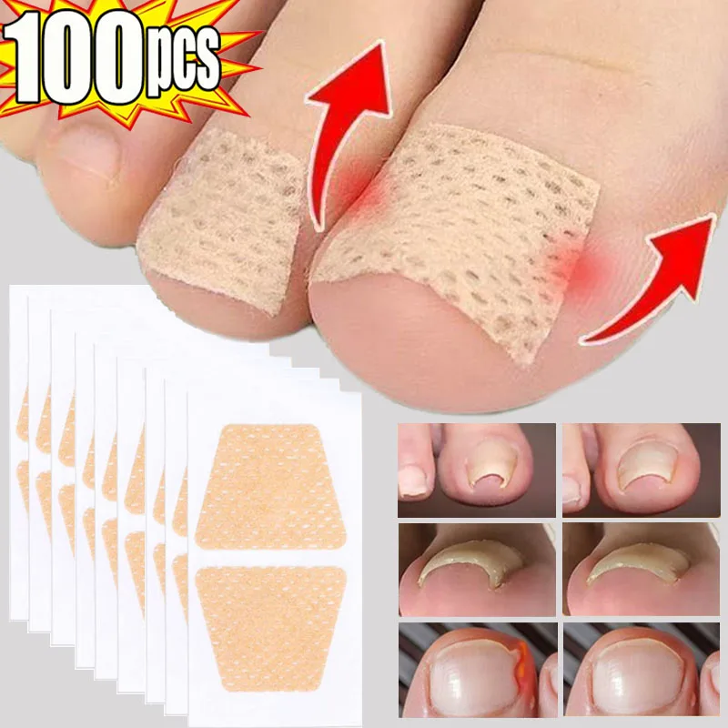 10/100Pcs Nail Treatment Patch Anti Fungal Nail Correction Sticker Ingrown Toenail Care Paronychia Anti Infection Repair Patch