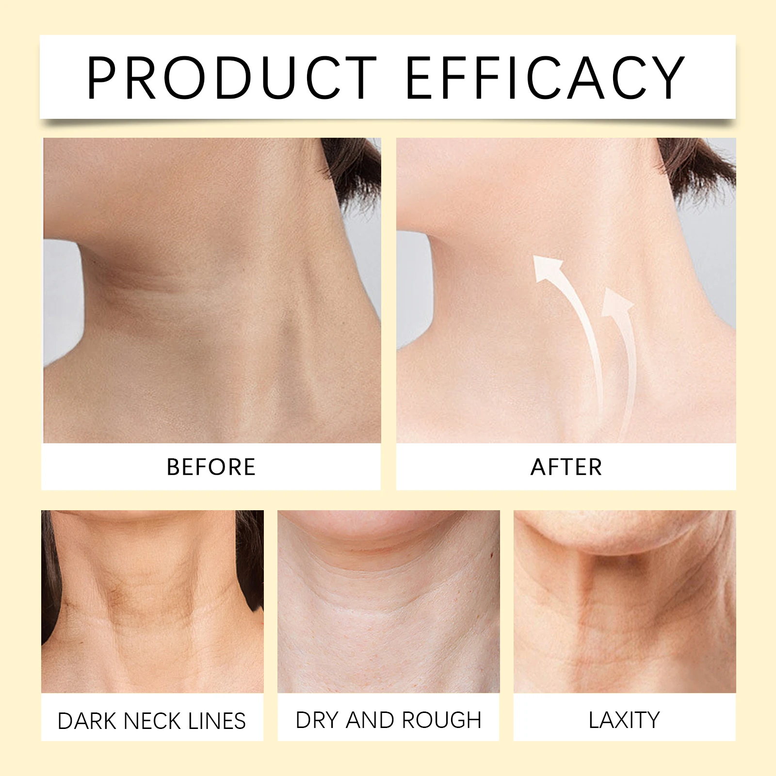 EELHOE 40 جرام كريم سم النحل عصا لشد البشرة تفتيح خطوط الرقبة تتلاشى التجاعيد الدقيقة ترطيب تحسين ترهل الجلد العناية بالوجه #2