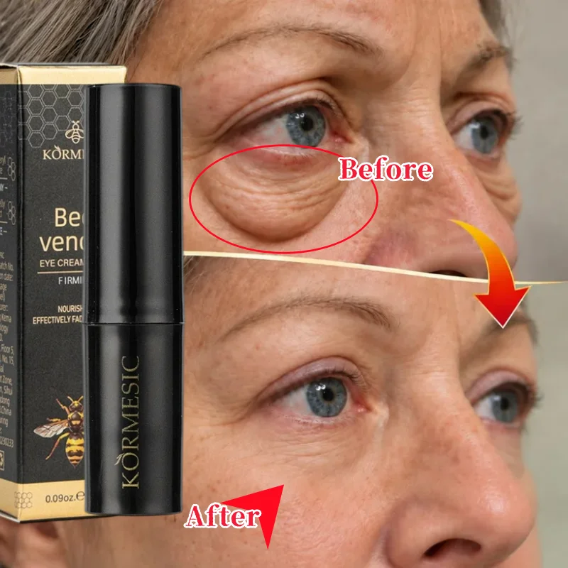 Retinol Eye Cream Stick Firming Repair Improves Elasticity Reduces Puffiness Fine Lines Sunken Areas Tear Trough Eyes Care Cream