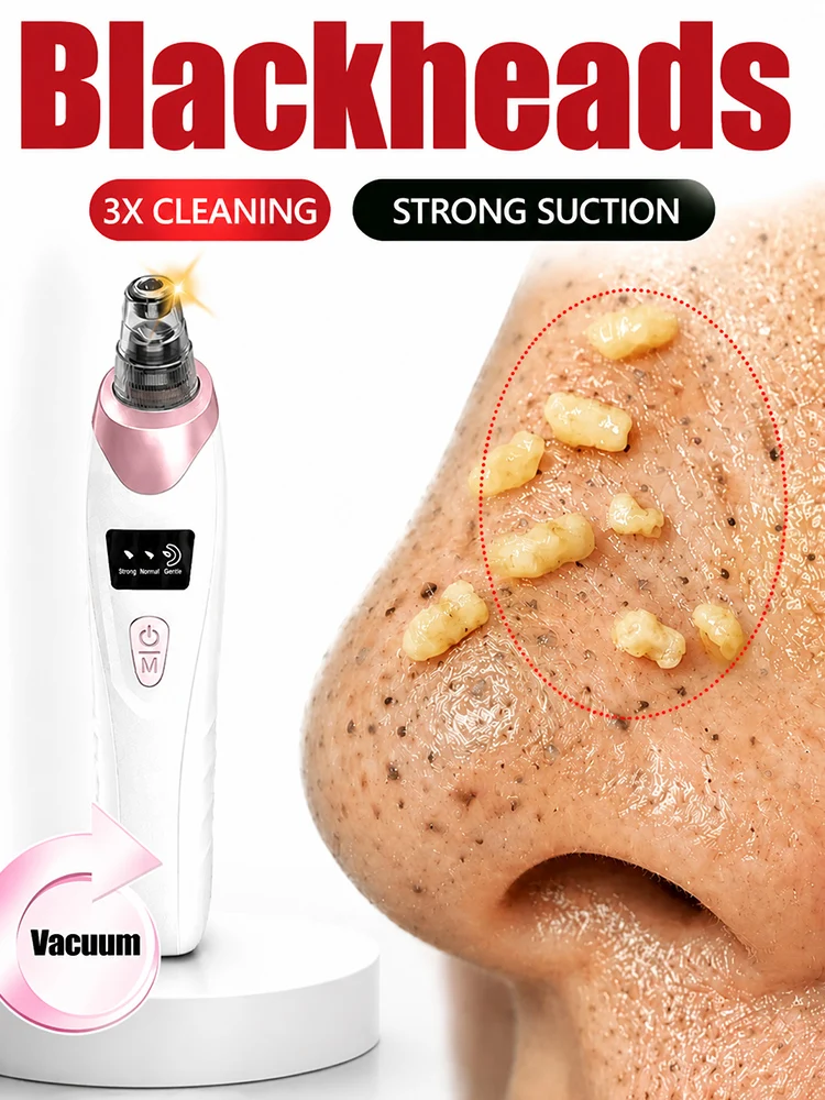 2026 New Blackhead Vacuum Cleaner and Facial Blackheads Cleaner