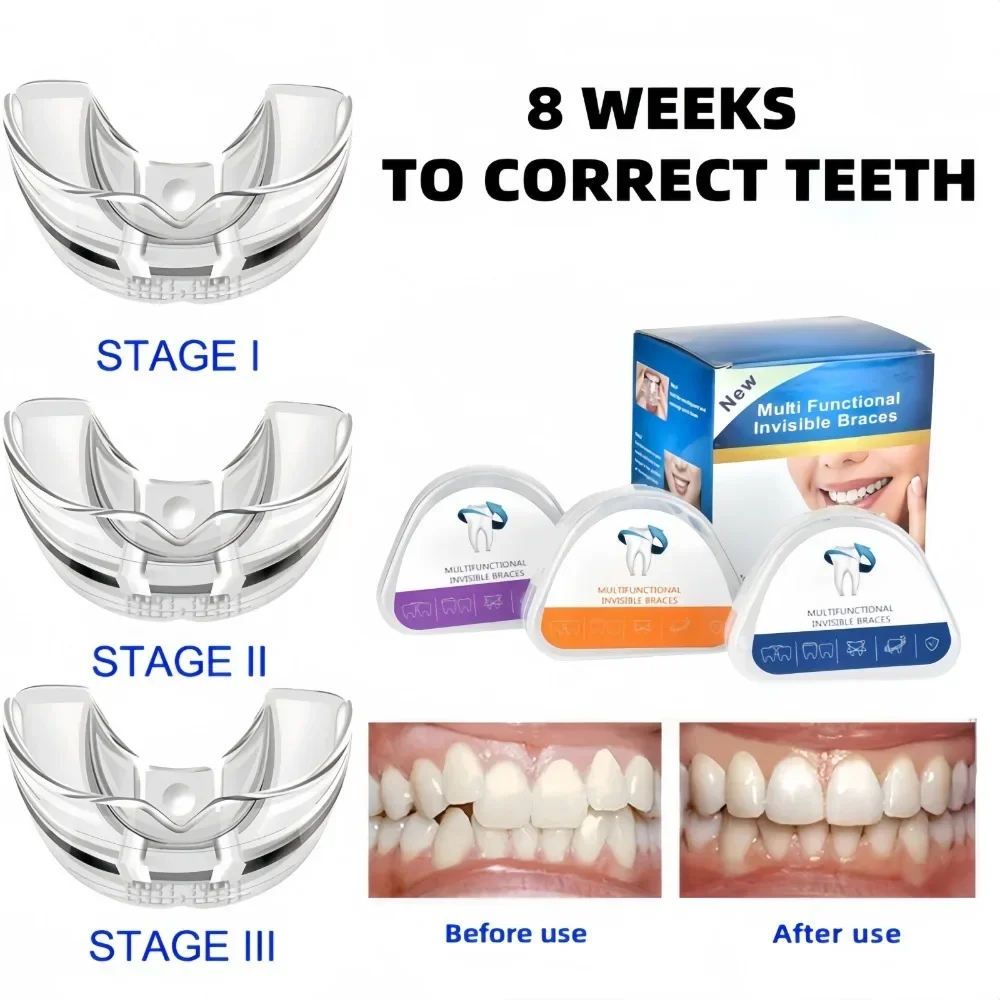 

Orthodontic Dental Braces Smile Teeth Alignment Trainer Instant Silicone Retainer Mouth Guard Tooth Tray for Dental Health