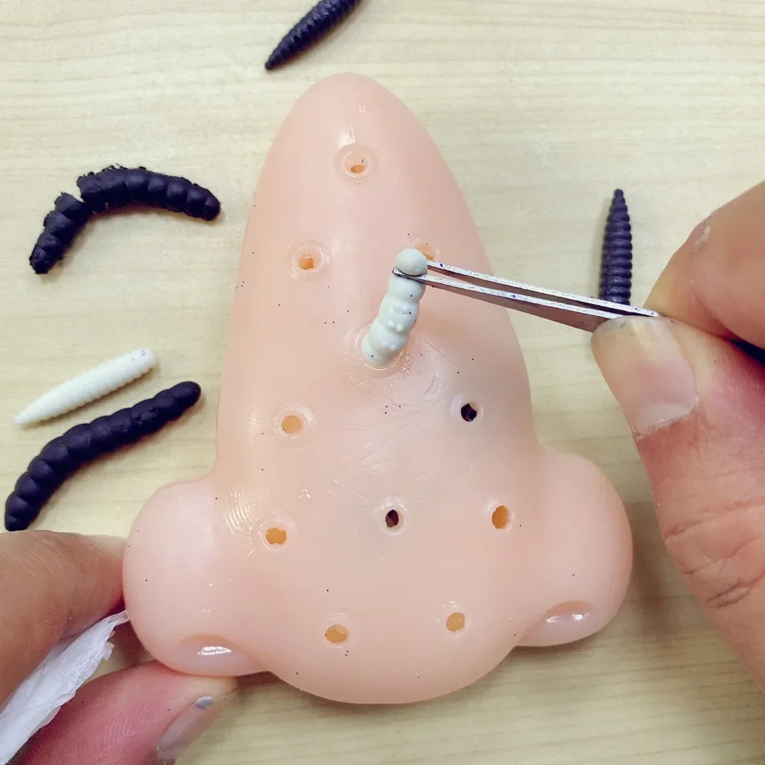 1 pçs espinha popping cravos removedor brinquedo engraçado acne espremendo truque jogo ansiedade alívio brinquedos de descompressão