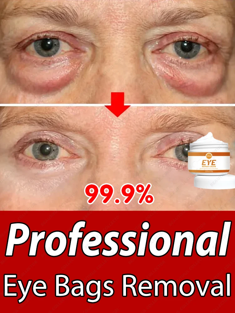 Quickly Eye Bags Cream Removal Eyes Wrinkle Fine Line