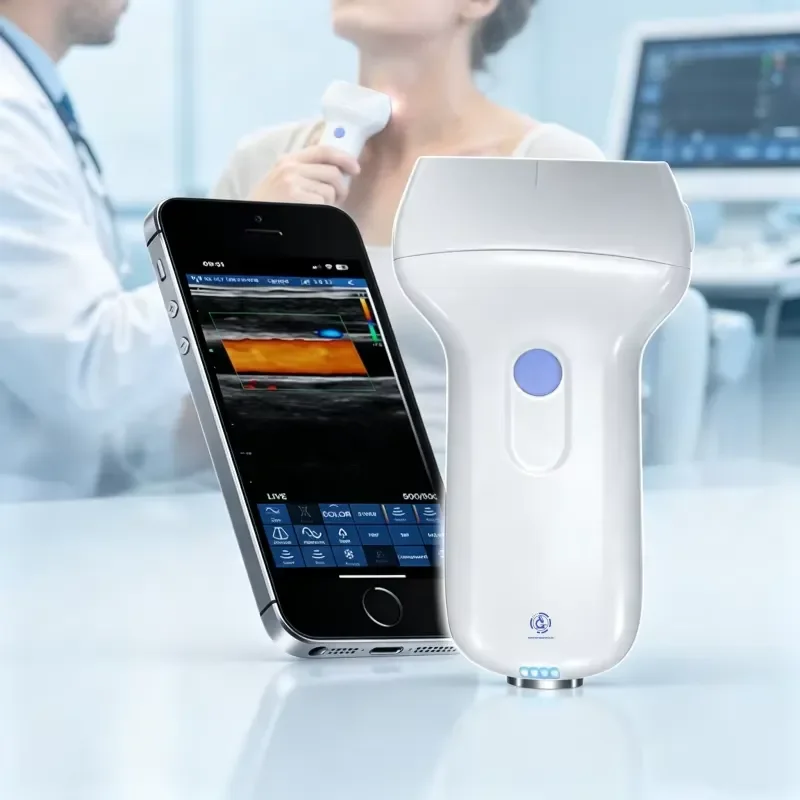 CE Diagnostic Equipment USG Wifi Ecografos Production USB Probe Wireless Image Mode