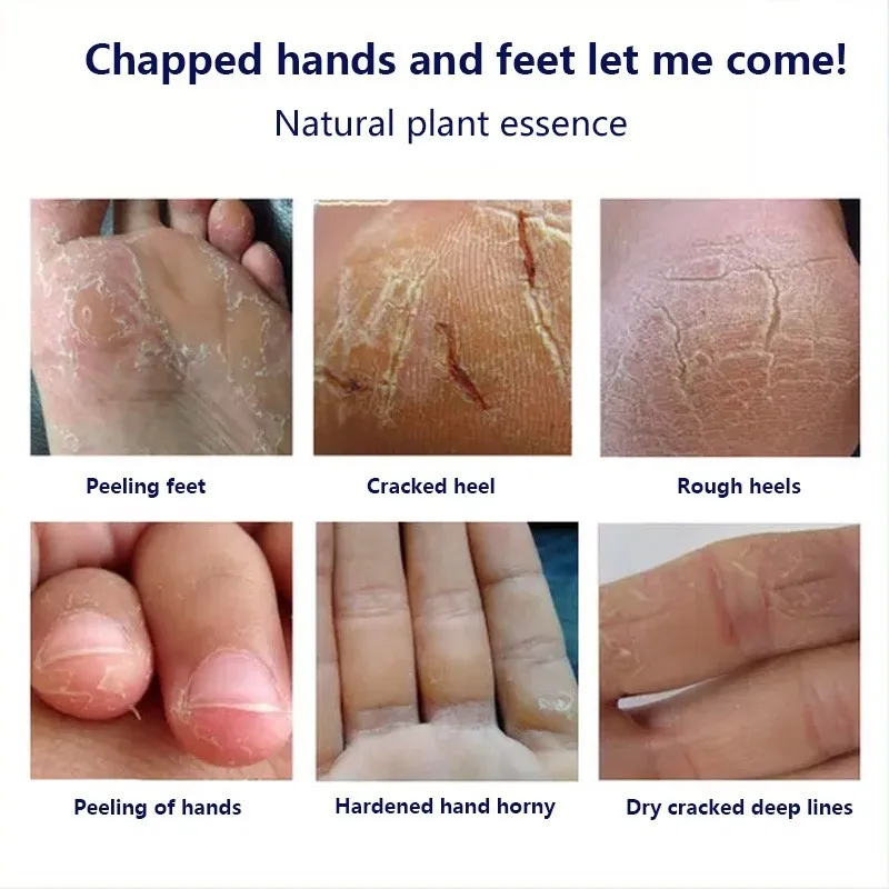 Size Traditional Chinese Upgrade Oil Anti-Drying Crack Foot Cream Heel Cracked Repair Cream Removal Dead Skin Hand Feet Care