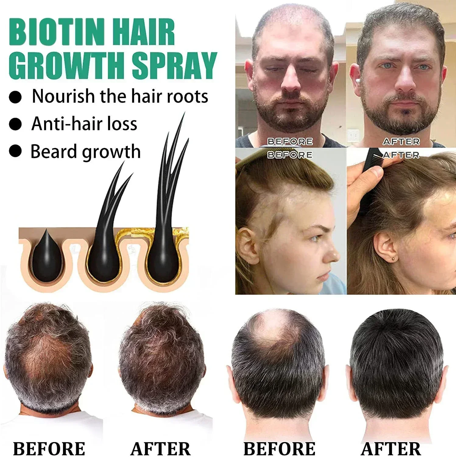 🌳Hair Growth Products Biotin Anti Hair Loss Spray Scalp Treatment Fast Growing Hair Care Essential Oils For Men Women