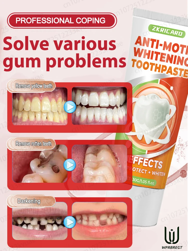 Repair cavities Protect teeth Prevent cavities