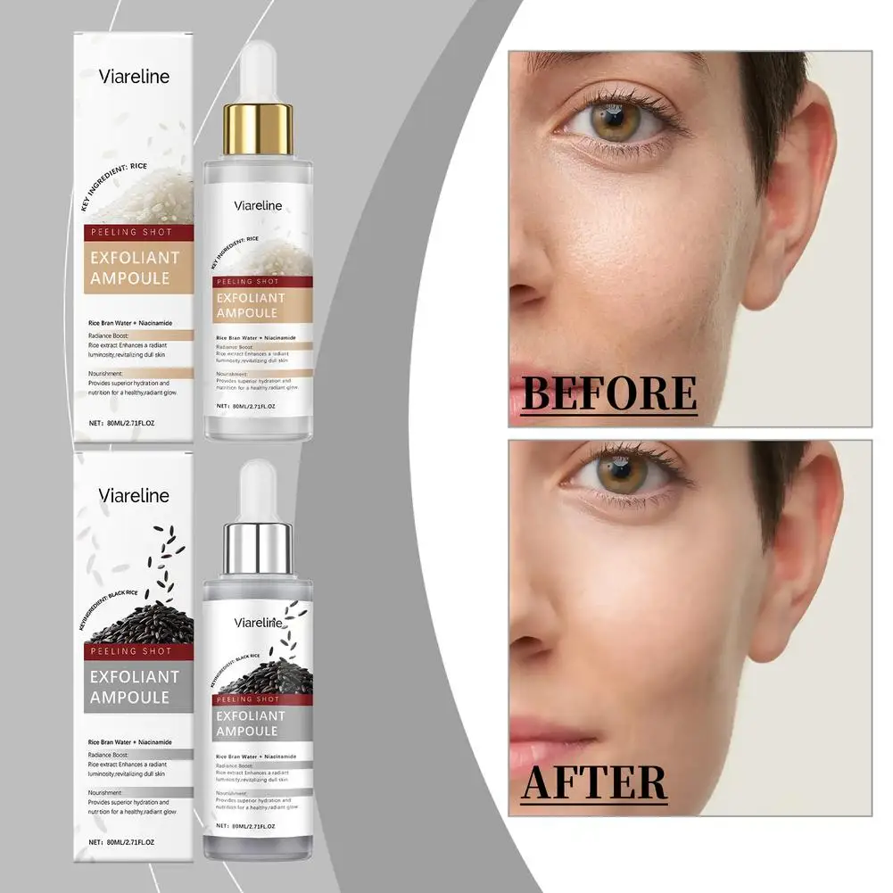 

Exfoliating Facial Serum Cleansing Pores Remove Dead Black Moisturizing Skin Control Rice Serum Smoothing Brightening Oil P B4D4