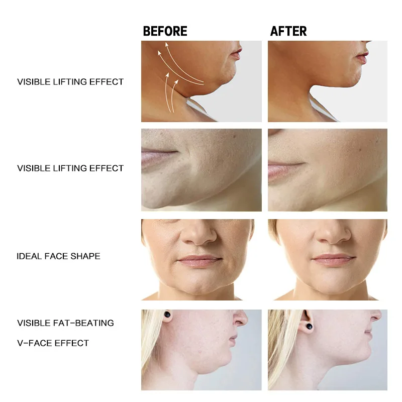2026 hot new products  perfect V face