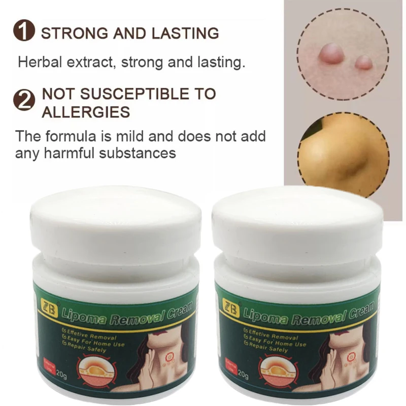 20G Treatment Lipoma Removal Cream Skin Swelling Cellulite Remover Ointment Lipolysis Fat Lump Body Hard Block Removal Medicine