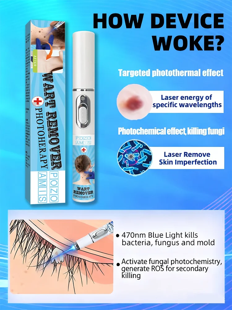 جذر إصلاح الثآليل الجيل السادس عشر المحسن بسرعة واحدة #5