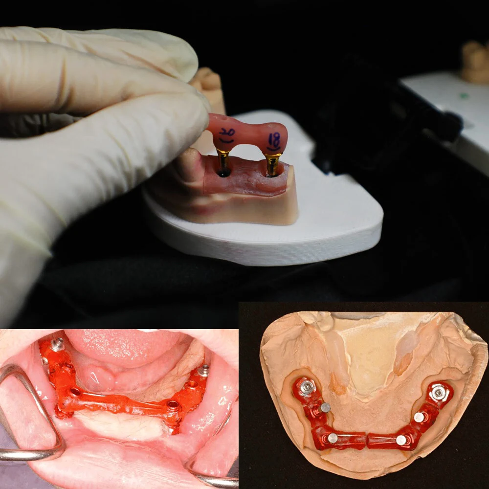 Dental Pattern Resin LC Flow Laboratory Material Modeling Light Curing Composite For Holding Abutment 12ml Bridge Implant Jig