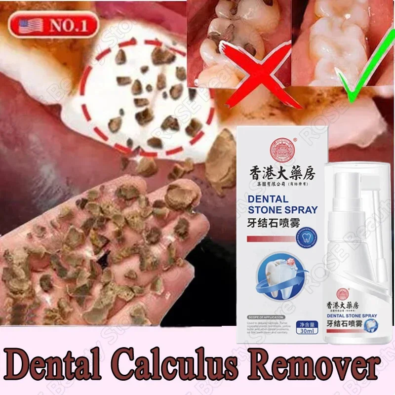 

Dental Calculus Remover Teeth Whitening Spray Toothpaste Cleaning Oral Hygiene Removal Halitosis Plaque Stains Fresh Breath Care