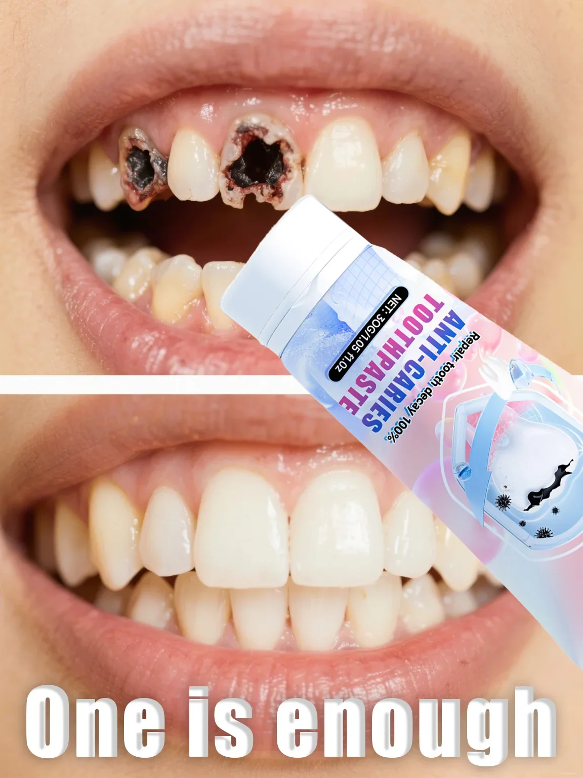 ⁹⁹% 사람들은 치아의 부식을 치료하고 치아를 보호합니다. 잇몸 관리, 상쾌한 숨결