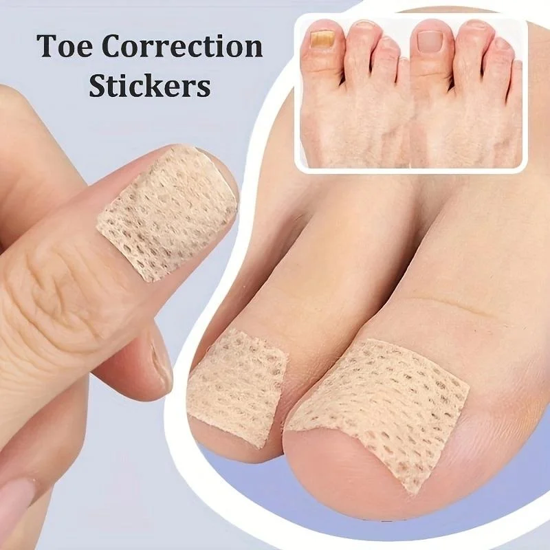 10pcs Ingrown Toenails Band Aid Relief Pain Paronychia Correction Pedicure Elastic Force Sticker Bandage Toe Nail