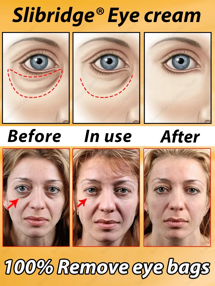 Eye Bag Remove Cream Dark Circles Eyes