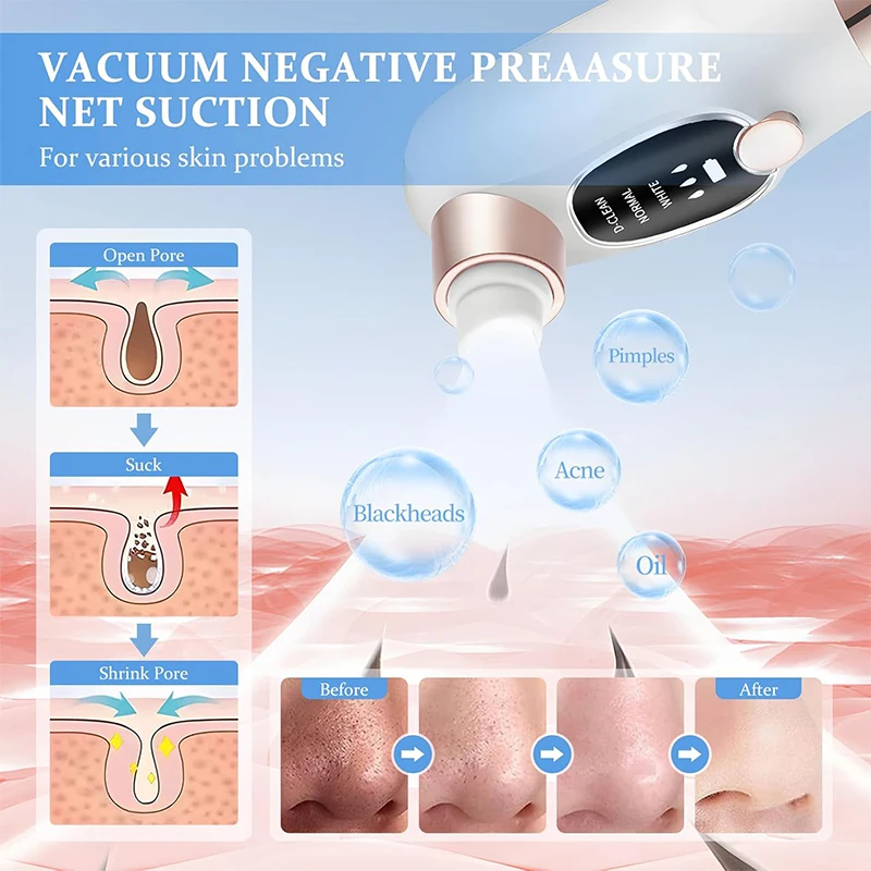 Electric Blackhead Remover Pore Vacuum Face Cleaner Pimple Acne Black Head Removal Water Cycle Black Dot Remove Cleasing Machine
