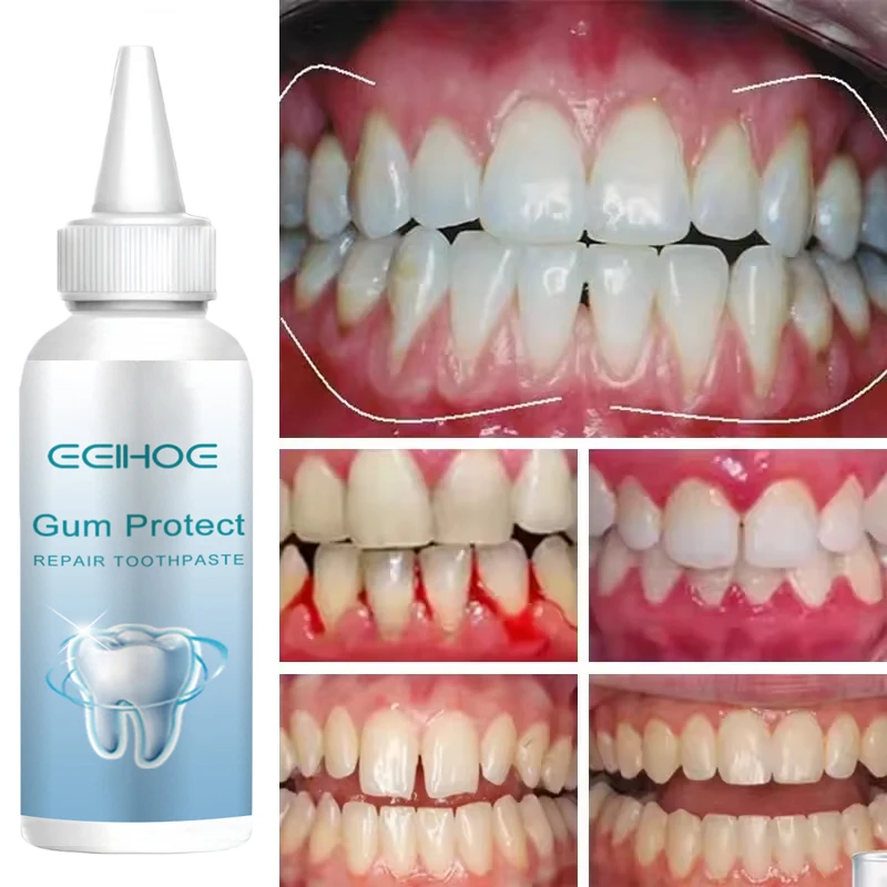 Damaged Gum Repair Care Toothpaste Relieve Sore Gums Allergy Deep Cleaning Teeth Stains Tartar Serum Dental Caries Toothpaste