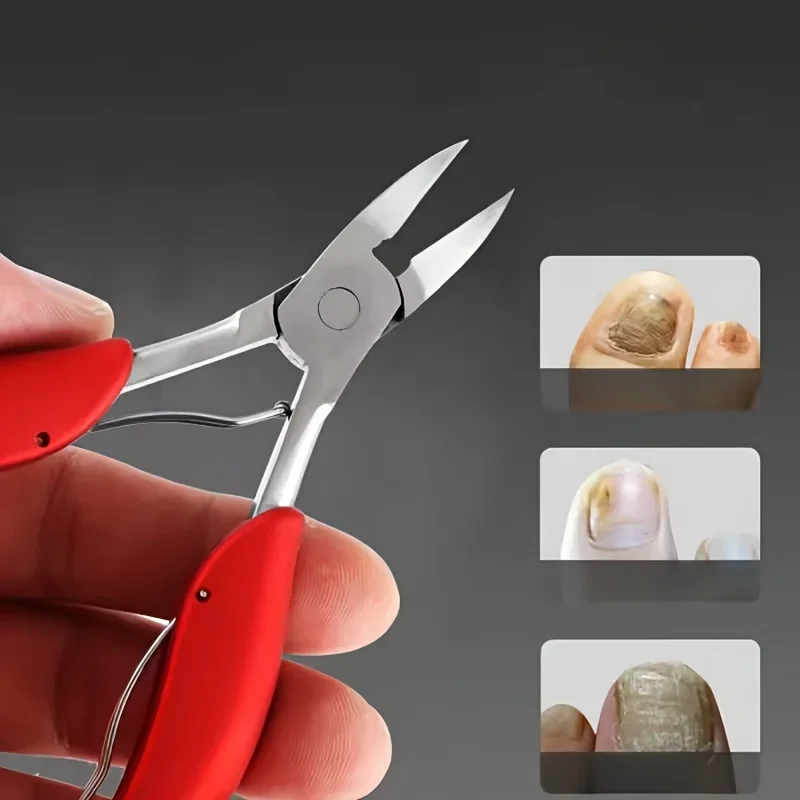 في سن المراهقة Nagelknipper القاطع Ingegroeide Teennagel أداة Dcke Nagel Dode Huid Vuil مزيل سوبر Scherpe Gebogen Mes Nail T