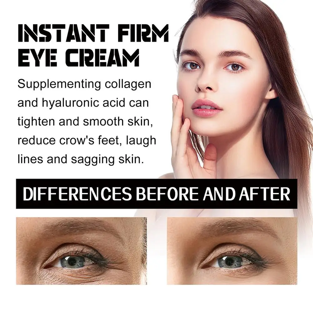 Beutel entfernung Augen creme verblassen feine Linien Augen essenz Lifting Creme Augen auge entfernen Haut straffen der Augen kreis dunkle Pflege nouris n8r2