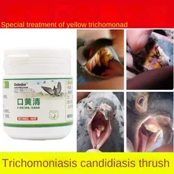 Pigeon Huang Jingkou Huang Qing Trichomonas Thrush White Spots In The Throat Macula Oral Ulcers Candida