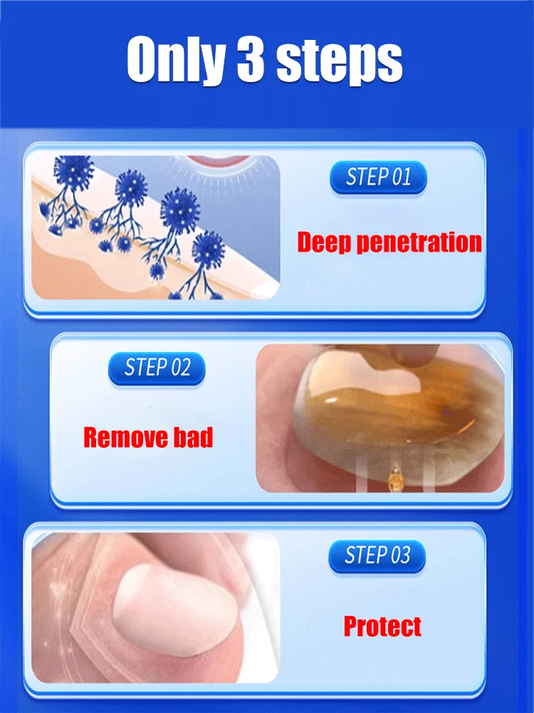 manicure for bad Can in 7 days farewell