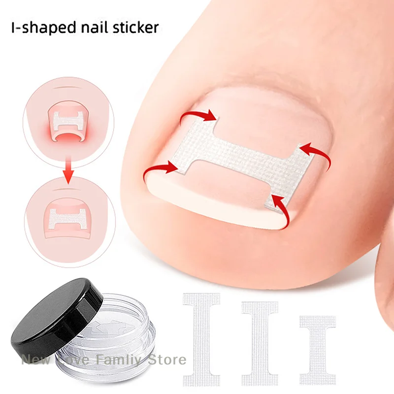 10 Pcs I-beam Orthodontic Strips Endogenous Toenail Correction Strips Nail Treatment Elastic Corrective Clip  Foot Care Tools