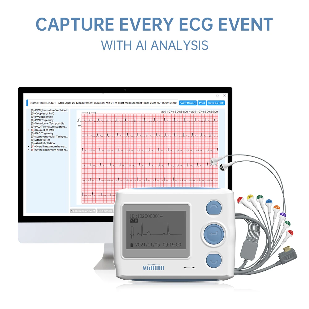 Medical Ai smart Analysis 12 Leads Holter Monitor Electrode Machine wearable Ecg Device 24H EKG Recording free PC Software