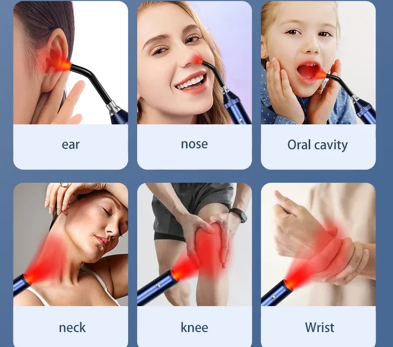 460nm 630nm 660m 850nm 900nm LED Nose Ear Canal Soothing Physiotherapy Lips Oral Light Guide Column LED Red Flashlight
