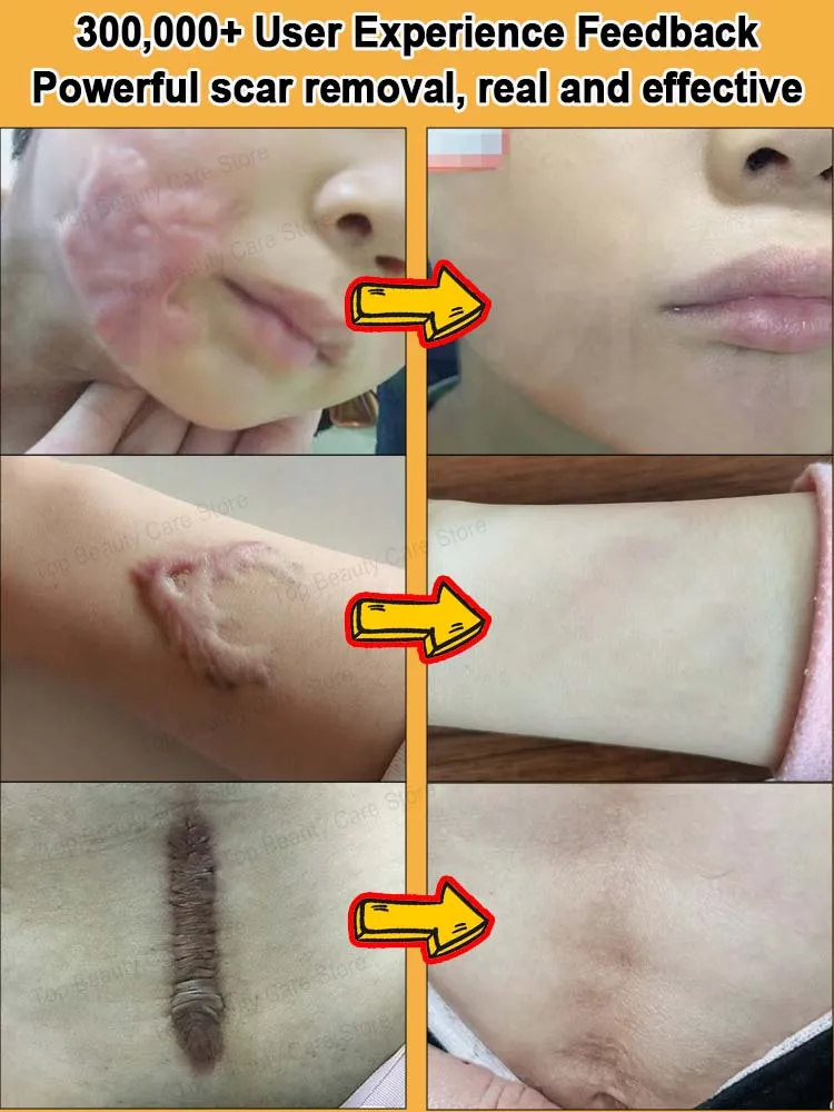 The technology repairs damaged skin layers layer by layer.