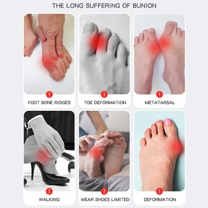 Big Toe Bunion Corrector, einstellbare, orthopädische Socken, Fingerspitzen, Schmerzlinderung, Hallux Valgs, Protektorfüße, Pflegewerkzeuge Fuß, 1PC 10 Hauptverkauf Juine Broker - №8
