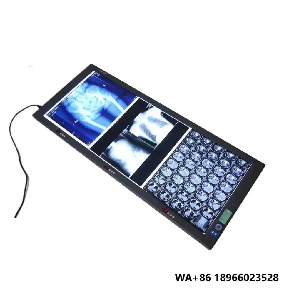 Medizinischer LED-Röntgen-Negatoskop mit dreifachem Röntgenfilmbetrachter