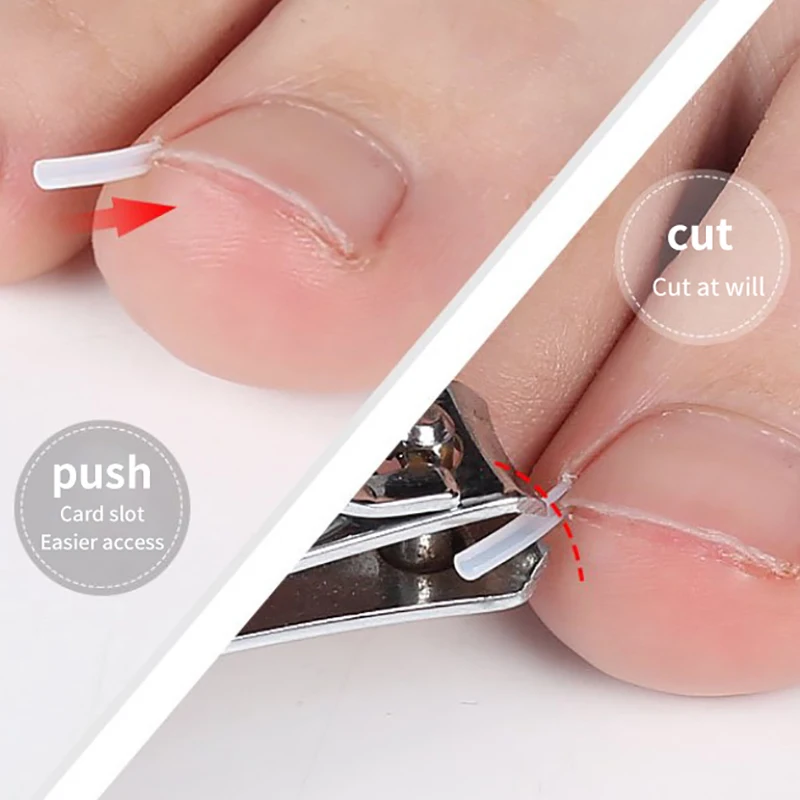 

50/100/250Pcs Ingrown Toenail Correction Tool Ingrown Toe Nail Treatment Patch Sticker Straightening Clip Brace Pedicure Tool