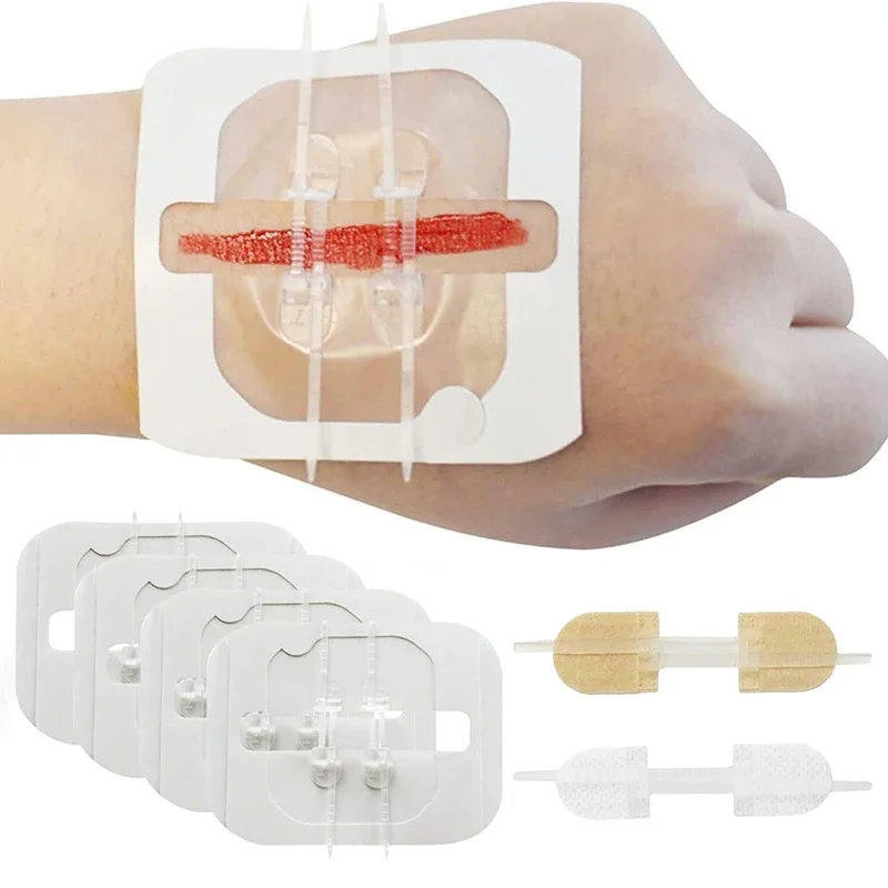 1/3/10/50 Patches Butterfly Closure Bandage Strips Adhesive Strip Stitch Bandages For Closing Skin Wounds With Non-Stick Pad