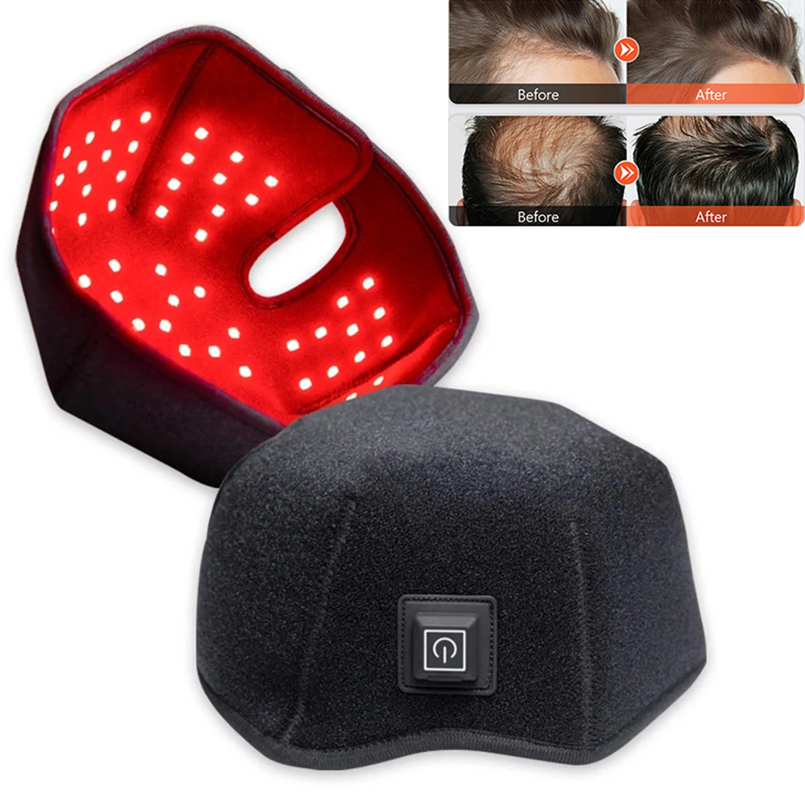 Thumbnail 2 - #11 Compare Hair Loss Treatments Before You Buy