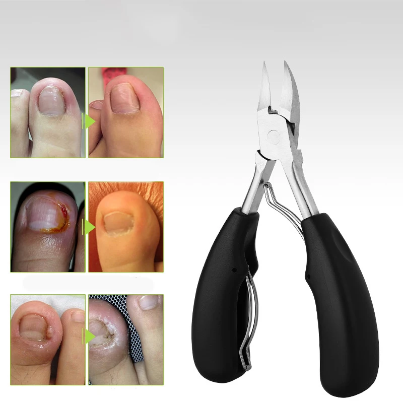 Toe Nail Clippers Remove Dead Skin Nail Correction Nippers Ingrown Toenail