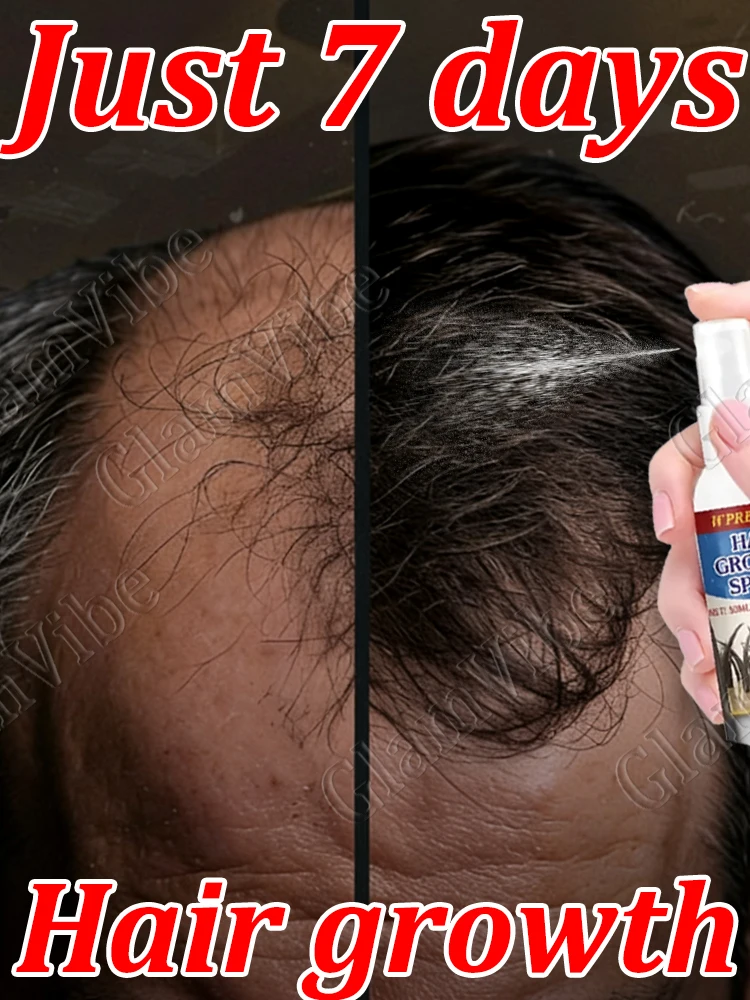 

Hᴀɪʀ sᴘʀᴀʏ time can't be turned back. Bᴜᴛ ʏᴏᴜʀ ʜᴀɪʀ ᴄᴀɴ.