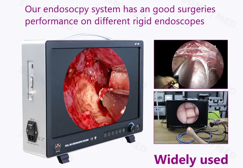 Sinuscope Video Processor Whole Full HD  Set All in One Endoscope Camera Medical Endoscope Camera