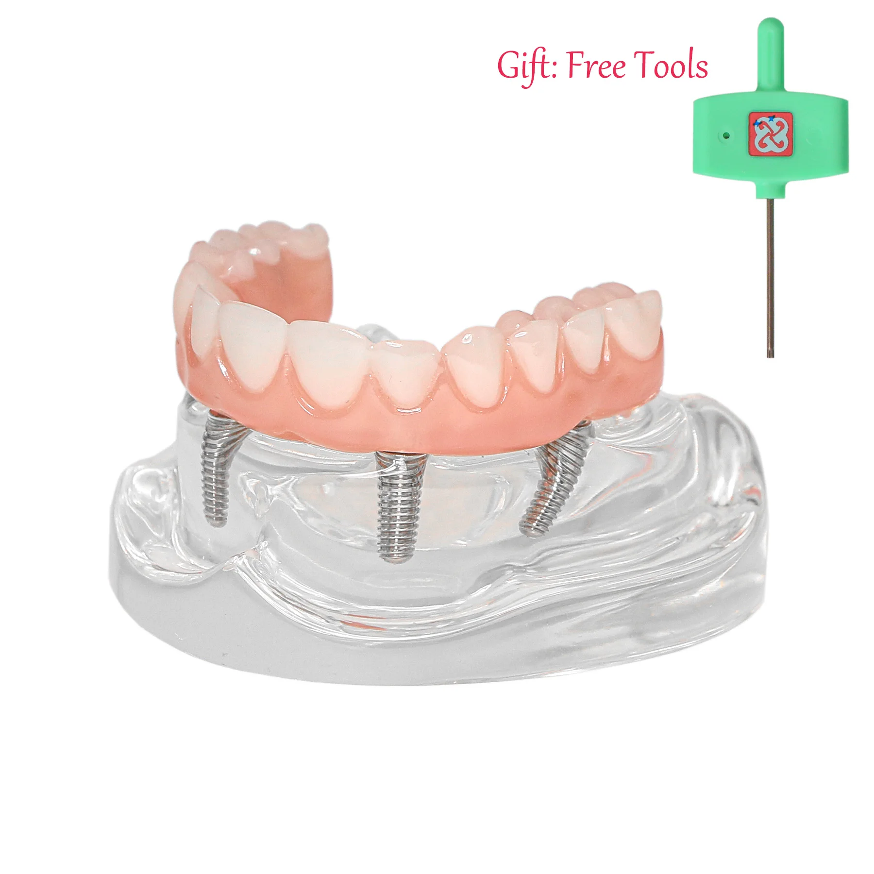 

Dental Teeth Model Simulation Transparent Upper Jaw 4 Overdenture Modle With 4 Removable Screws Dentist Teaching Studying Demo