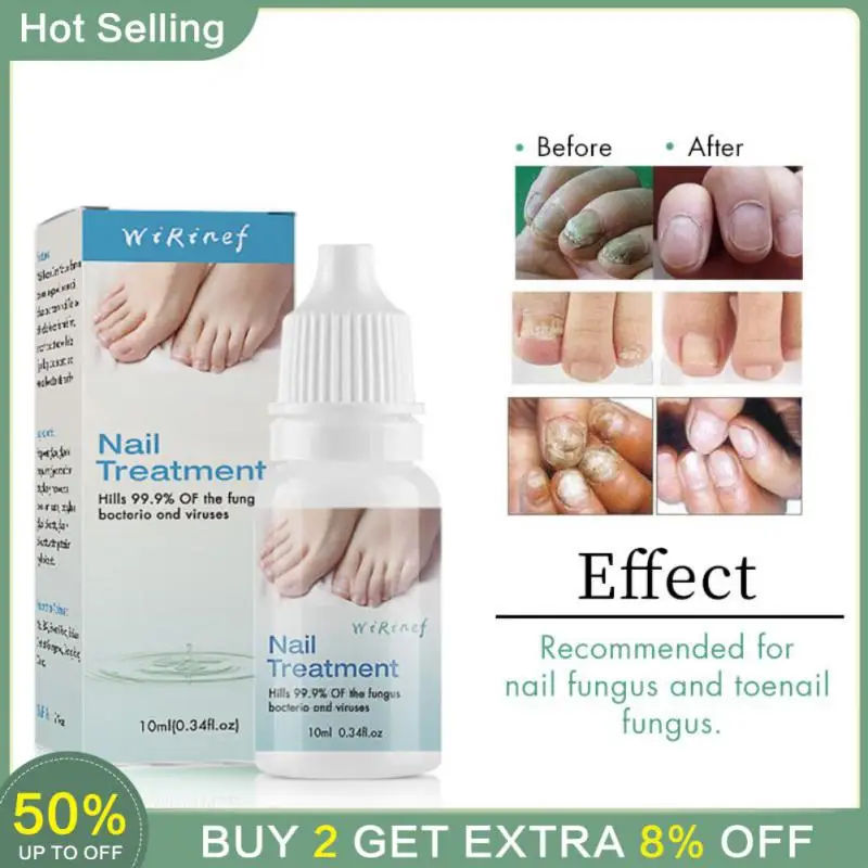 Toe Nail Fungus Remover Fast Acting Revolutionary Nail Fungus For Men Anti Nail Fungus Cure Popular Powerful