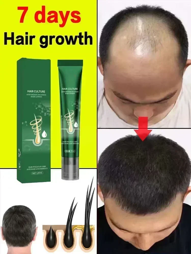 Prevent Hair Loss Repair Hair Strong Hair Growth Spray Nourishes Roots Quickly Regenerates For Men Women Growth Spray