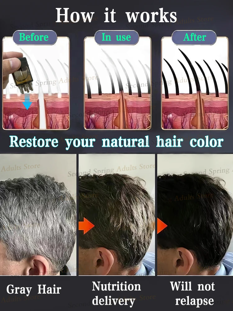 Soro de reversão de cabelo cinza ——Rescar sua cor natural!