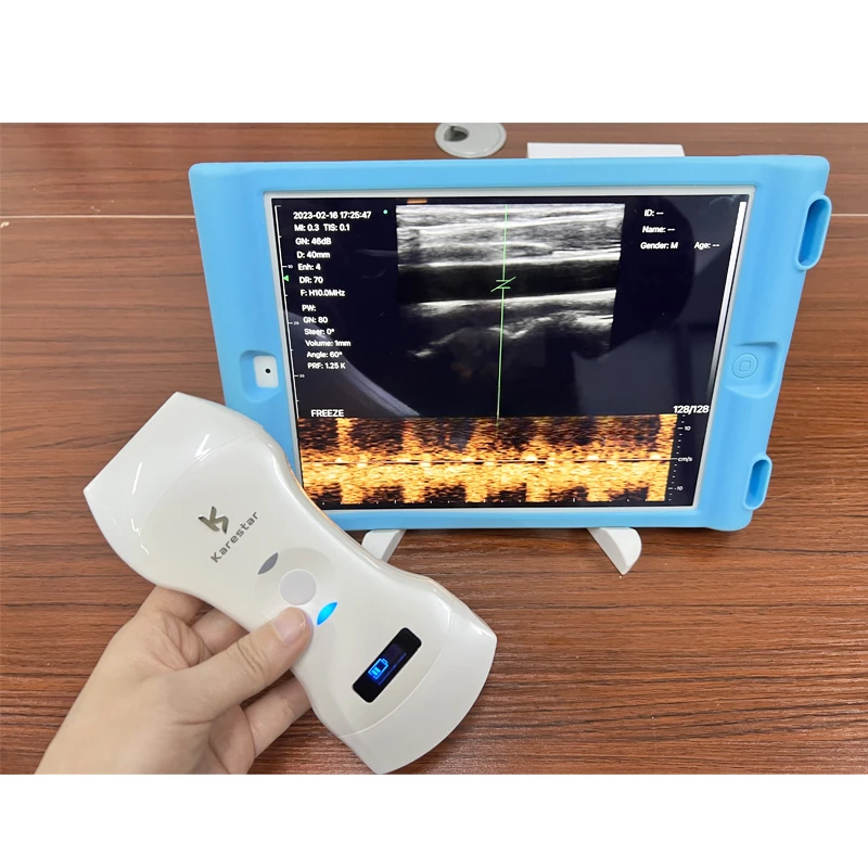 K-TC101 veterinary machine portable medical ultrasound instruments Super clear image 3 in 1 wireless wifi ultrasound