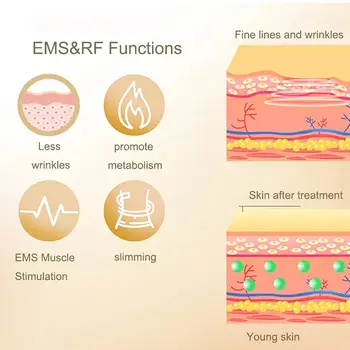 10 best sales Lipo makinesi - №8