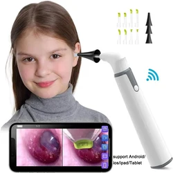 Wireless Otoscope Ear Camera 3.9mm 1080P HD WiFi Ear Scope with 6 LED Lights for Kids and Adults Support Android and iPhone