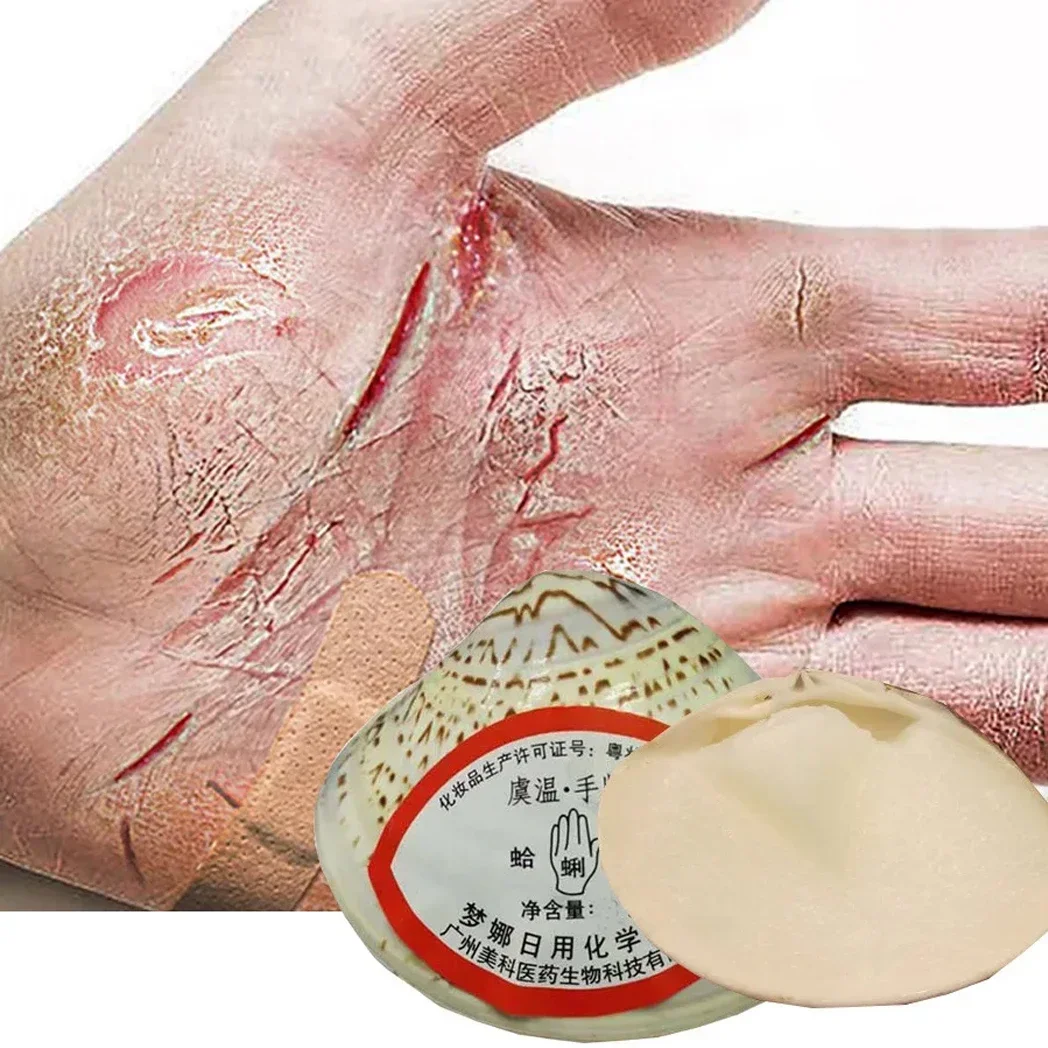 Traditional Chinese Clam Oil Cracked Repair Cream Anti-Drying Removal Dead Skin Hand Feet Foot Moisturize Care Oil Care Ointment