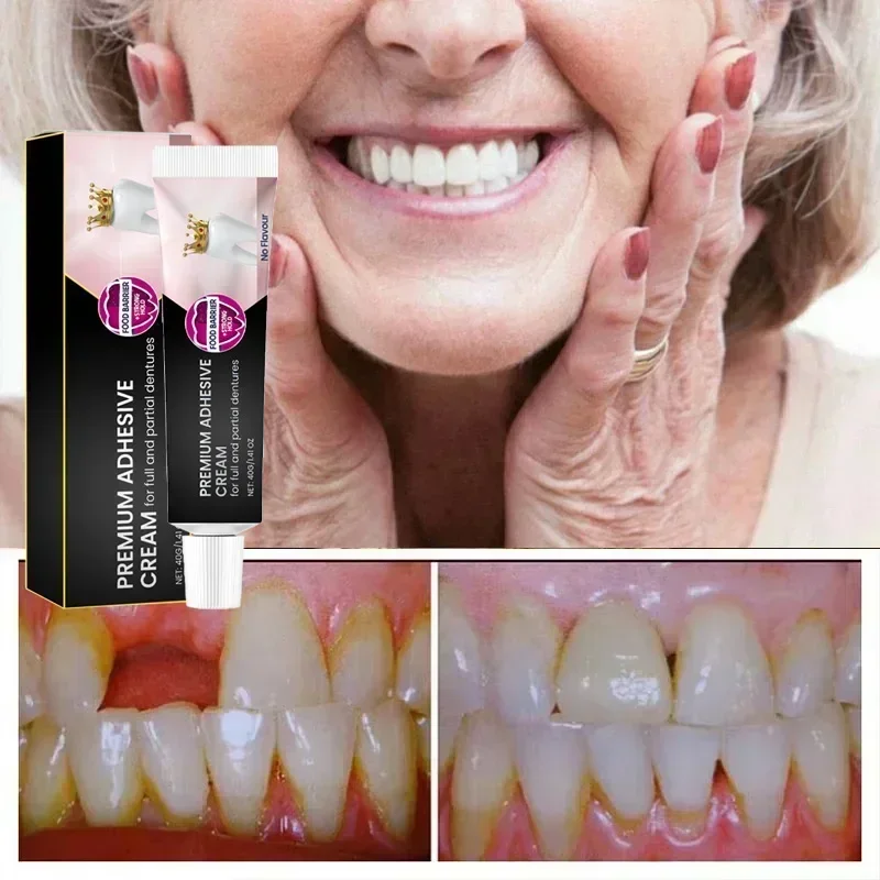Denture Fixing Adhesive Improve The Comfort Of Denture Wear Prevent Denture Loosen Thermoplastic Adhesive Falseteeth Solid Glue